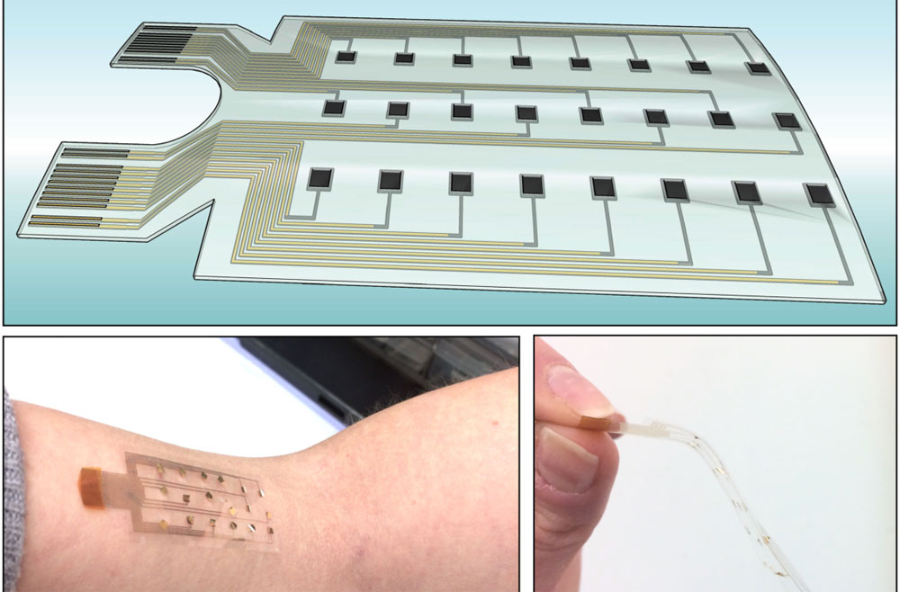 Vitale EMG electrodes